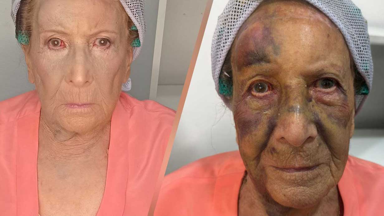 Heridas y golpes